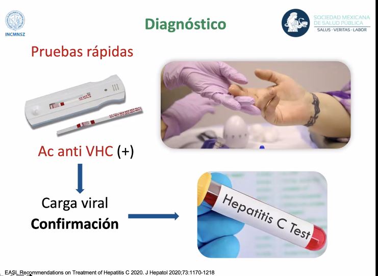 La Hepatitis C Es Una Enfermedad Curable Smsp Energ A Hoy